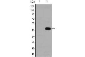Western blot analysis using CEA mAb against HEK293 (1) and CEA(AA: 460-600)-hIgGFc transfected HEK293 (2) cell lysate. (CEA antibody)