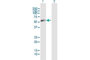 Western Blot analysis of ZNF232 expression in transfected 293T cell line by ZNF232 MaxPab polyclonal antibody. (ZNF232 antibody  (AA 1-444))