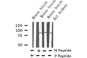 Western blot analysis of Phospho-Tau (Ser262) Antibody expression in mouse brain and rat kidney tissues lysates. (MAPT antibody  (pSer262))