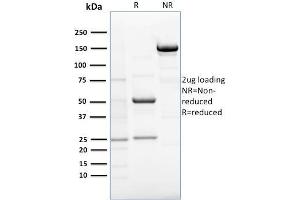 SDS-PAGE Analysis Purified RCAS1 Mouse Monoclonal Antibody (CPTC-EBAG9-1). (RCAS1 antibody)