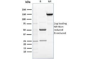 SDS-PAGE Analysis Purified RCAS1 Mouse Monoclonal Antibody (CPTC-EBAG9-1).