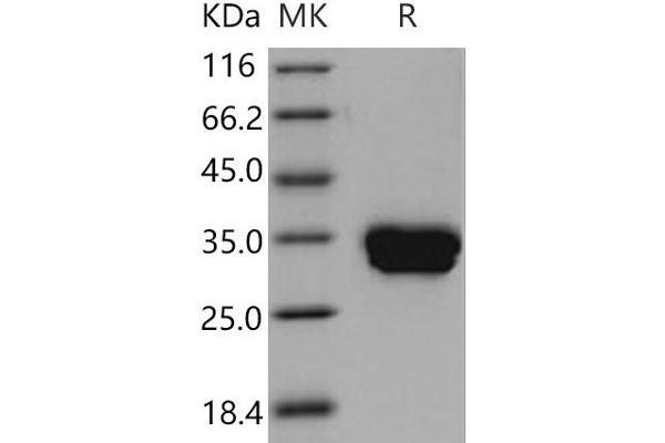 CA4 Protein (His tag)