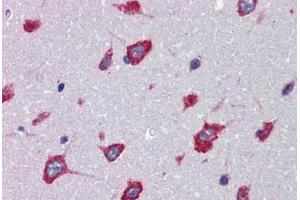 Brain, cortex, Human: Formalin-Fixed, Paraffin-Embedded (FFPE) (SRPX2 antibody  (C-Term))