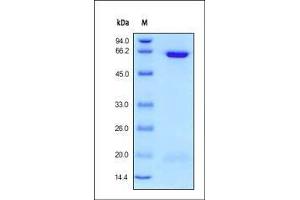 Human PCSK9, His Tag on SDS-PAGE under reducing (R) condition. (PCSK9 Protein (AA 31-692) (His tag))