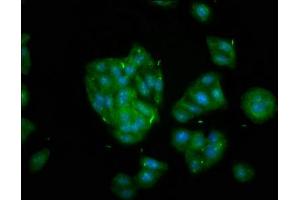 Immunofluorescence staining of HepG2 cells with ABIN7157616 at 1:133, counter-stained with DAPI. (KIF2B antibody  (AA 1607-1731))