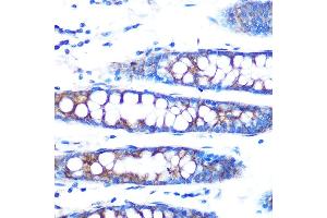 Immunohistochemistry of paraffin-embedded human colon using BMP4 Rabbit mAb (ABIN7265898) at dilution of 1:100 (40x lens). (BMP4 antibody)