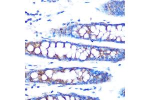 Immunohistochemistry of paraffin-embedded human colon using BMP4 Rabbit mAb (ABIN7265898) at dilution of 1:100 (40x lens). (BMP4 antibody)