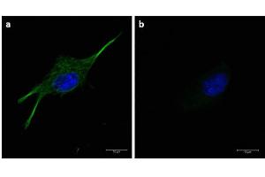 Immunofluorescence of α-tubulin using FITC-conjugated Fluorescent anti-mouse IgG Immunofluorescence microscopy of α-tubulin in U-87 MG cells using FITC-conjugated Fluorescent anti-mouse IgG  for detection.