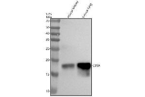 Western blot analysis of LY6A using anti-LY6A antibody (ABIN7605462).