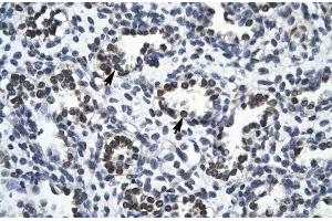 Rabbit Anti-RBM10 Antibody Catalog Number: ARP30103 Paraffin Embedded Tissue: Human Lung Cellular Data: Alveolar cells Antibody Concentration: 4. (RBM10 antibody  (N-Term))