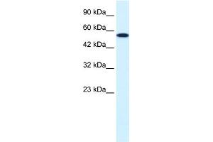 WB Suggested Anti-CHEK1 Antibody Titration:  0. (CHEK1 antibody  (Middle Region))