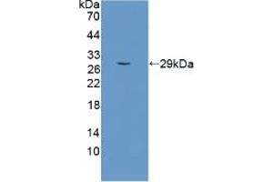 Detection of Recombinant SCO2, Human using Polyclonal Antibody to SCO Cytochrome Oxidase Deficient Homolog 2 (SCO2)