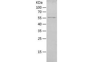 Western Blotting (WB) image for Interferon Induced with Helicase C Domain 1 (IFIH1) (AA 700-1025) protein (His-IF2DI Tag) (ABIN7288674) (IFIH1 Protein (AA 700-1025) (His-IF2DI Tag))