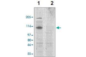 The tissue lysates derived from mouse heart (lane 1) or rat heart (lane 2) were immunoprobed by Corin polyclonal antibody  at 1 : 500. (Corin antibody  (AA 300-450))