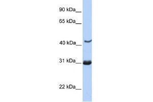 NUP35 antibody used at 1 ug/ml to detect target protein. (NUP35 antibody  (C-Term))