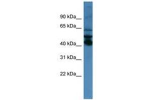 Image no. 1 for anti-Septin 1 (SEPT1) (AA 140-189) antibody (ABIN6746705) (Septin 1 antibody  (AA 140-189))