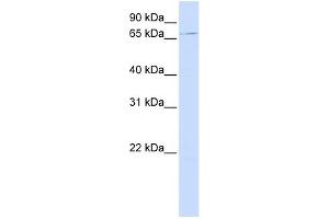 UNC84B antibody used at 1 ug/ml to detect target protein. (SUN2 antibody)