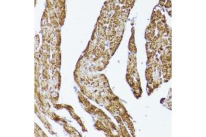 Immunohistochemistry of paraffin-embedded rat heart using VD Rabbit pAb (ABIN7271337) at dilution of 1:150 (40x lens). (VDAC2 antibody  (AA 1-100))