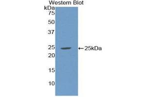 Western Blotting (WB) image for anti-Sex Hormone Binding Globulin (SHBG) (AA 224-388) antibody (ABIN1172834) (SHBG antibody  (AA 224-388))