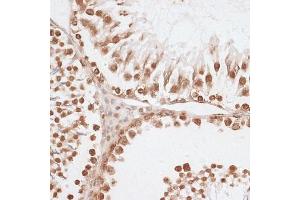 Immunohistochemistry of paraffin-embedded rat testis using Histone H2AX antibody (ABIN7267725) at dilution of 1:100 (40x lens). (Histone H2A antibody  (C-Term))