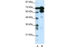 Western Blotting (WB) image for anti-Zinc Finger Protein 76 (Expressed in Testis) (ZNF76) antibody (ABIN2461696) (ZNF76 antibody)