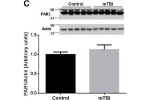 PAR1 antibody  (AA 251-350)