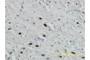 Immunoperoxidase of monoclonal antibody to SNRPA on formalin-fixed paraffin-embedded human heart tissue. (SNRPA1 antibody  (AA 1-282))