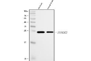 Western blot analysis of Synaptogyrin 3/SYNGR3 using anti-Synaptogyrin 3/SYNGR3 antibody (ABIN7601760). (Synaptogyrin 3 antibody  (AA 45-229))