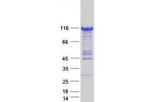 Western Blotting (WB) image for phosphorylase Kinase, alpha 1 (Muscle) (PHKA1) (Transcript Variant 2) protein (Myc-DYKDDDDK Tag) (ABIN2728839)