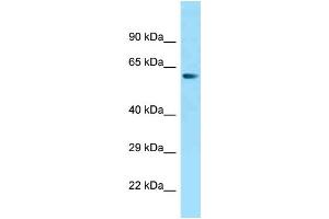 WB Suggested Anti-ZNF238 Antibody Titration: 1.
