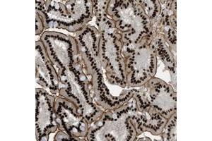 Immunohistochemical staining of human duodenum with ZFR polyclonal antibody  shows strong nuclear and membranous positivity in glandular cells at 1:10-1:20 dilution. (ZFR antibody)