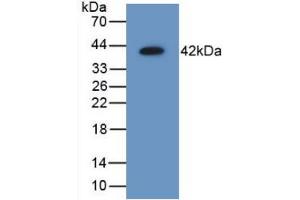 Figure. (AIMP1 antibody  (AA 2-310))