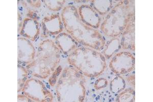 Figure. (TPM3 antibody  (AA 1-285))