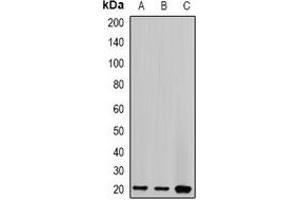Western blot analysis of Centrin-2 expression in HT29 (A), MCF7 (B), mouse spleen (C) whole cell lysates. (CETN2 antibody)