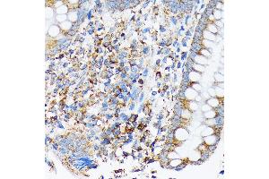 Immunohistochemistry of paraffin-embedded human appendix using CDC25B Rabbit mAb (ABIN7266250) at dilution of 1:100 (40x lens). (CDC25B antibody)