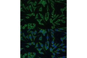 Immunofluorescence analysis of L929 cells using DDX3Y Polyclonal Antibody (ABIN6130260, ABIN6139496, ABIN6139497 and ABIN6215395) at dilution of 1:100 (40x lens). (DDX3Y antibody  (AA 1-210))