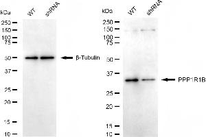 Western blotting analysis using PPP1R1B antibody (ABIN7800018). (Recombinant DARPP32 antibody)