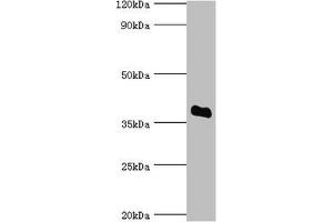 Western blot All lanes: Bile salt sulfotransferase antibody at 5 μg/mL + HepG2 whole cell lysate Secondary Goat polyclonal to rabbit IgG at 1/10000 dilution Predicted band size: 38 kDa Observed band size: 38 kDa (SULT2A1 antibody  (AA 1-145))