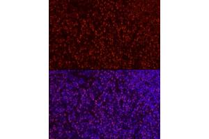 Immunofluorescence analysis of rat thymus cells using S Rabbit pAb (ABIN6130296, ABIN6147396, ABIN6147398 and ABIN6221485) at dilution of 1:50 (40x lens). (SATB1 antibody  (AA 484-763))