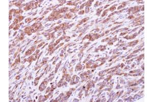Immunohistochemistry (IHC) image for anti-phosphoribosyl Pyrophosphate Synthetase 1 (PRPS1) (N-Term) antibody (ABIN2855446)