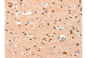 The image on the left is immunohistochemistry of paraffin-embedded Human brain tissue using ABIN7189955(BAZ1A Antibody) at dilution 1/25, on the right is treated with synthetic peptide. (BAZ1A antibody)