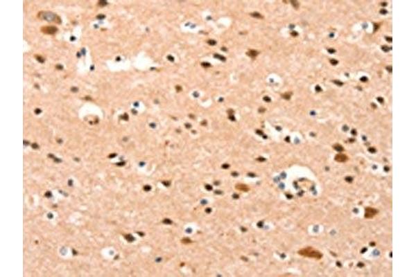 BAZ1A antibody