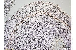 Formalin-fixed and paraffin embedded rat colon tissue labeled with Rabbit Anti-Leptin receptor(long) Polyclonal Antibody (ABIN725060) at 1:200 followed by conjugation to the secondary antibody and DAB staining. (Leptin Receptor antibody  (AA 901-1000))