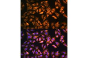Immunofluorescence analysis of U2OS cells using SO Rabbit pAb (ABIN6129624, ABIN6148259, ABIN6148260 and ABIN6221917) at dilution of 1:100. (SOAT1 antibody  (AA 1-130))