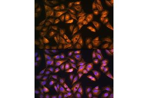 Immunofluorescence analysis of U2OS cells using SO Rabbit pAb (ABIN6129624, ABIN6148259, ABIN6148260 and ABIN6221917) at dilution of 1:100. (SOAT1 antibody  (AA 1-130))