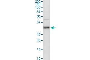 MAGEA9 MaxPab rabbit polyclonal antibody. (MAGEA9 antibody  (AA 1-315))