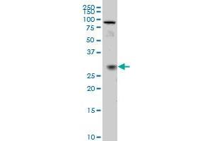 TGIF2 monoclonal antibody (M02), clone 5B11 Western Blot analysis of TGIF2 expression in IMR-32 . (TGIF2 antibody  (AA 131-236))