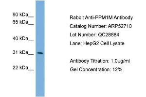WB Suggested Anti-PPM1M  Antibody Titration: 0. (PPM1M antibody  (Middle Region))