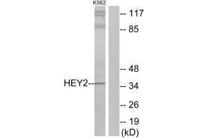 Western blot analysis of extracts from K562 cells, using HEY2 antibody. (HEY2 antibody)