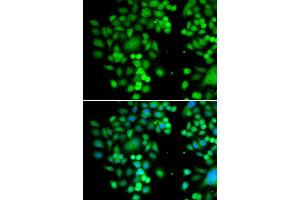 Immunofluorescence analysis of MCF-7 cells using PHYHD1 antibody (ABIN5974340). (PHYHD1 antibody)